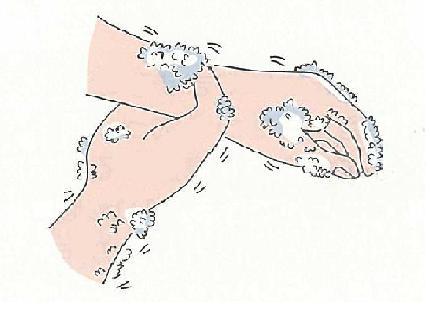 手首をあらう図